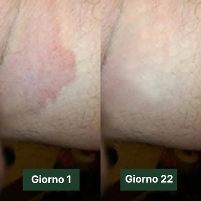 Velora Sapone Antimicotico