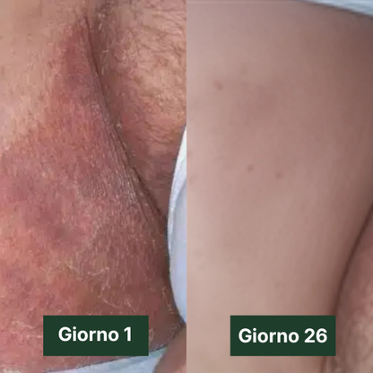 Velora Sapone Antimicotico