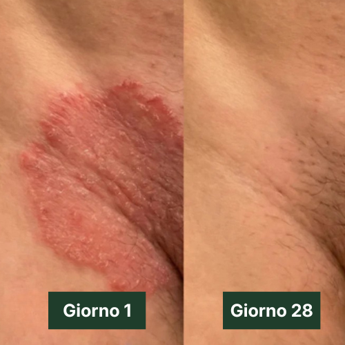 Velora Sapone Antimicotico